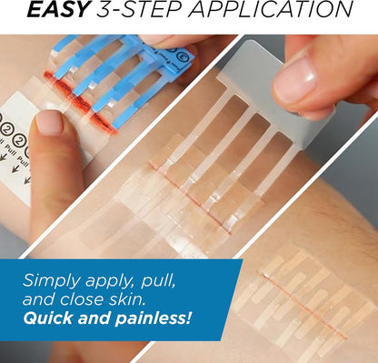 Complete Emergency Laceration Kit Repair Wounds Without Stitches FSA HSA Eligible Skin